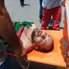 موظف يحرق نفسه إحتجاجا على فصله من عمله في الأنروا