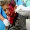 مقتل 43 طفلا يمنيا باستهداف حافلة في صعدة شمال اليمن