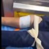 اصابة 3 شبان برصاص الاحتلال بينهم شاب من ذوي الاعاقة في بيت أمر